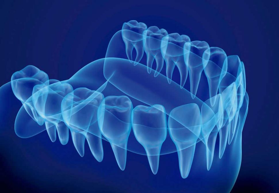 tecnologias que revolucionan la odontolgia
