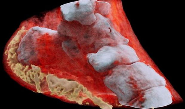 radiografias a color
