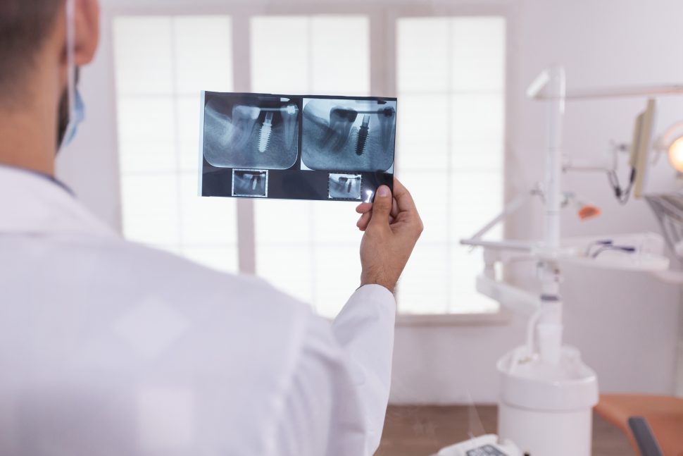 el mercado Equipos de radiología dental