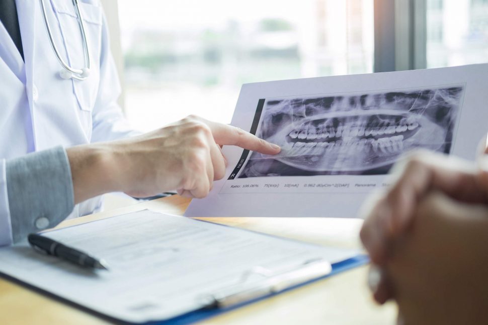 Radiografías Dentales y practicas seguras