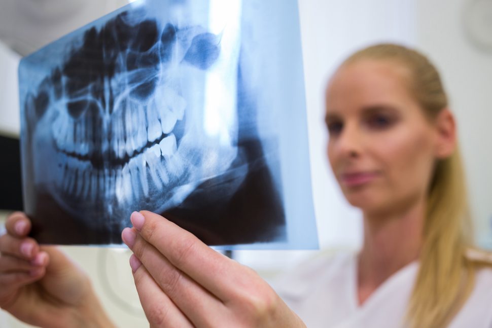 entender-las-radiografias-dentales
