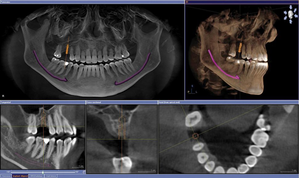 Cone beam Computed Tomography